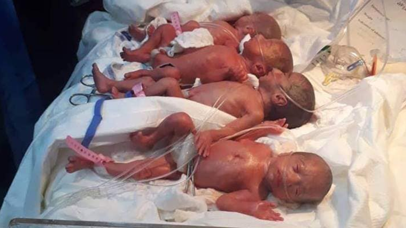 Insolite Une Femme Met Au Monde 6 Bebes En 9 Minutes Friaguinee